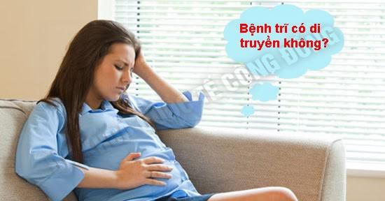 Bệnh trĩ di truyền không?