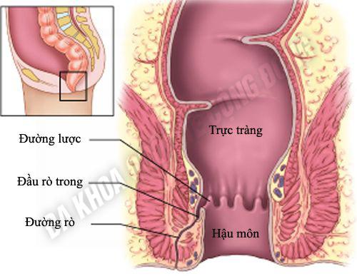 benh-ro-hau-mon-nguyen-nhan-va-cach-dieu-tri-1