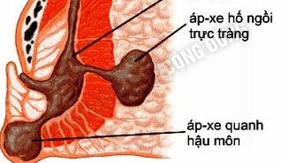 ap-xe-hau-mon-123_1