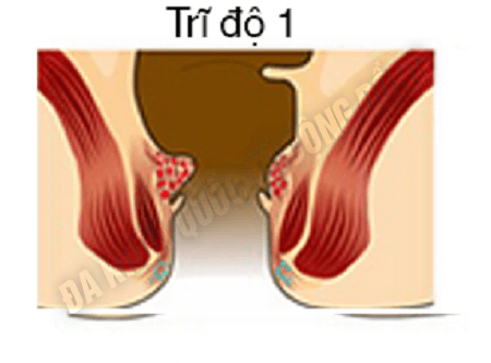 tri-noi-do-1