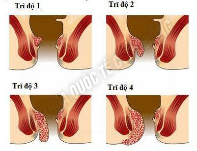 tri cac do_3