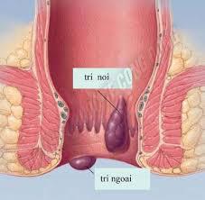 tri giai doan dau