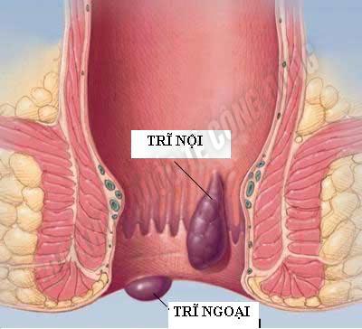 tri-noi-tri-ngoai